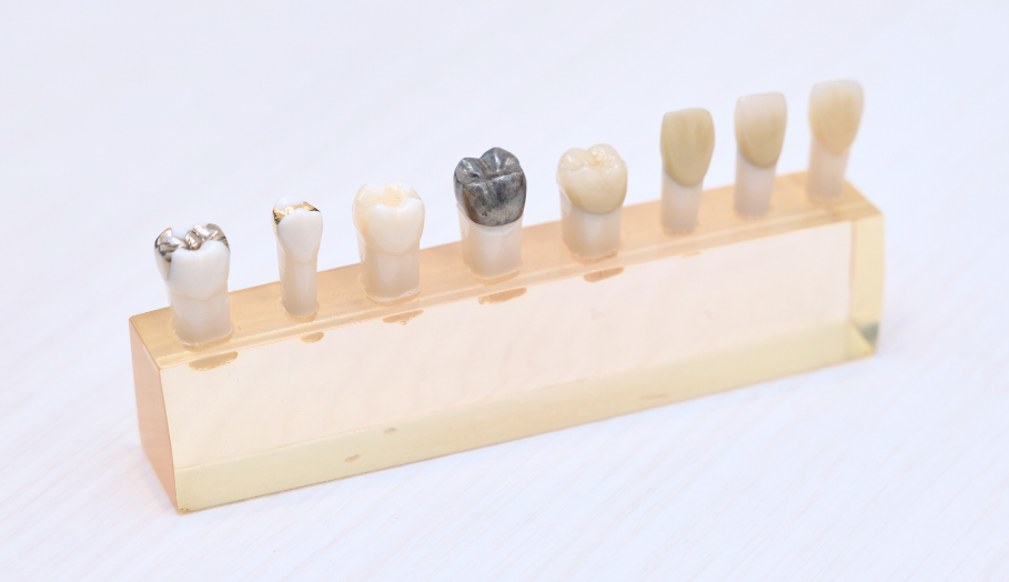 当院の審美修復治療|すずき歯科