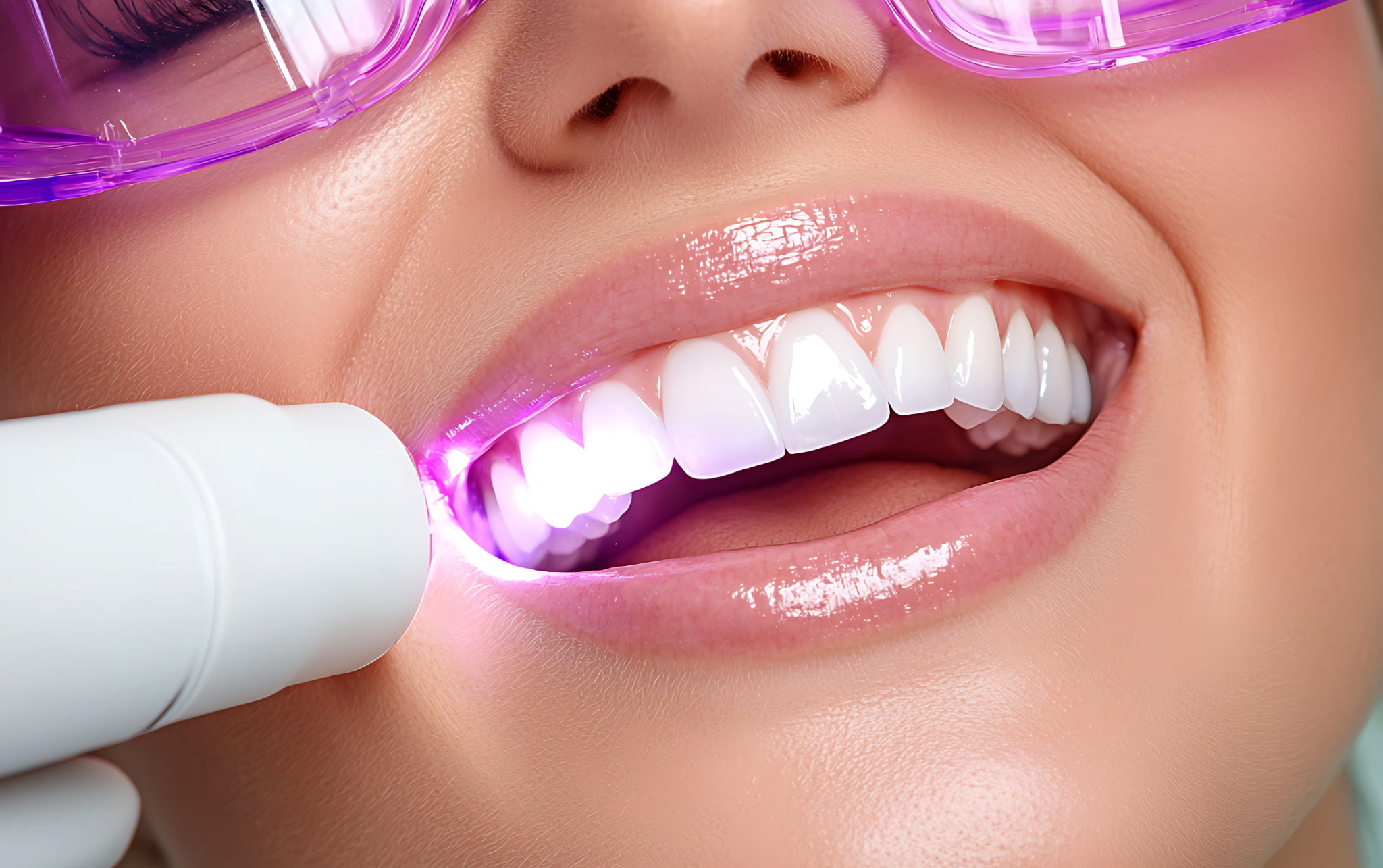 ホワイトニングの施術を受ける女性