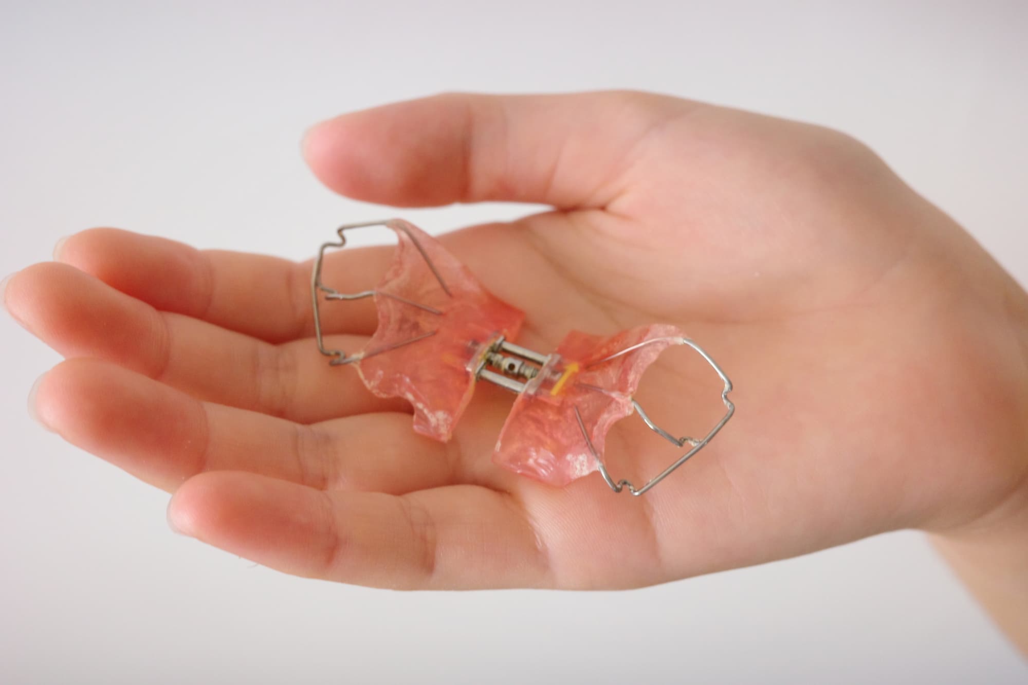 床矯正の装置を乗せた手