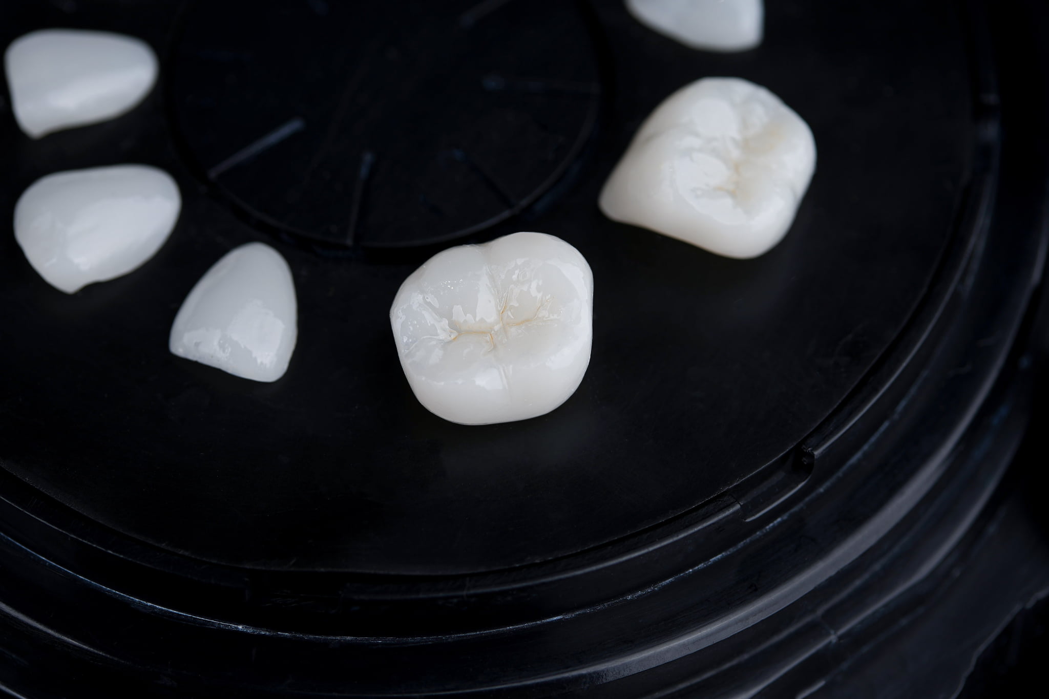 オールセラミックでできた歯のイメージ