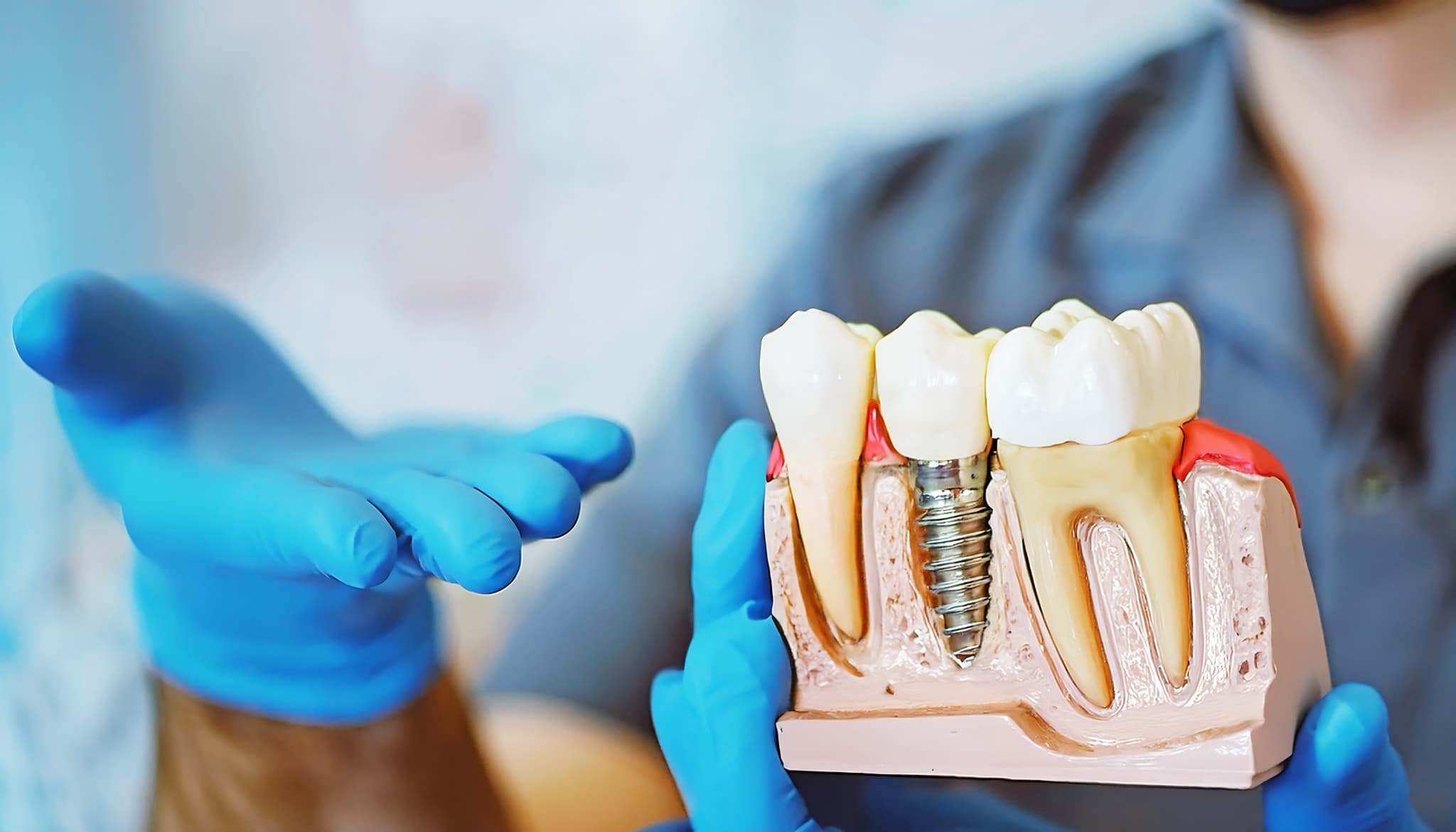 インプラントの模型をもつ歯科医師の手元