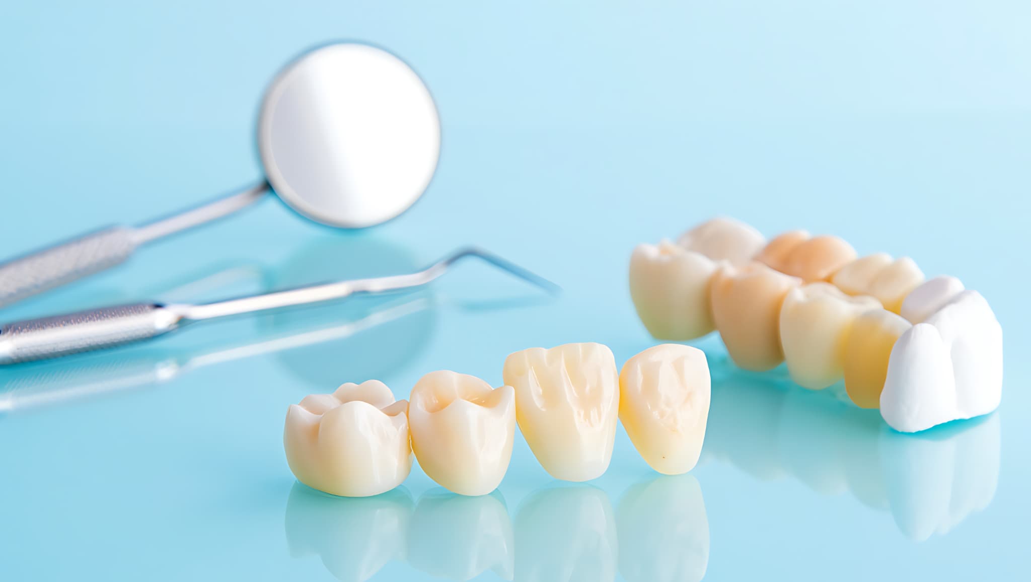 歯のブリッジ治療のイメージ