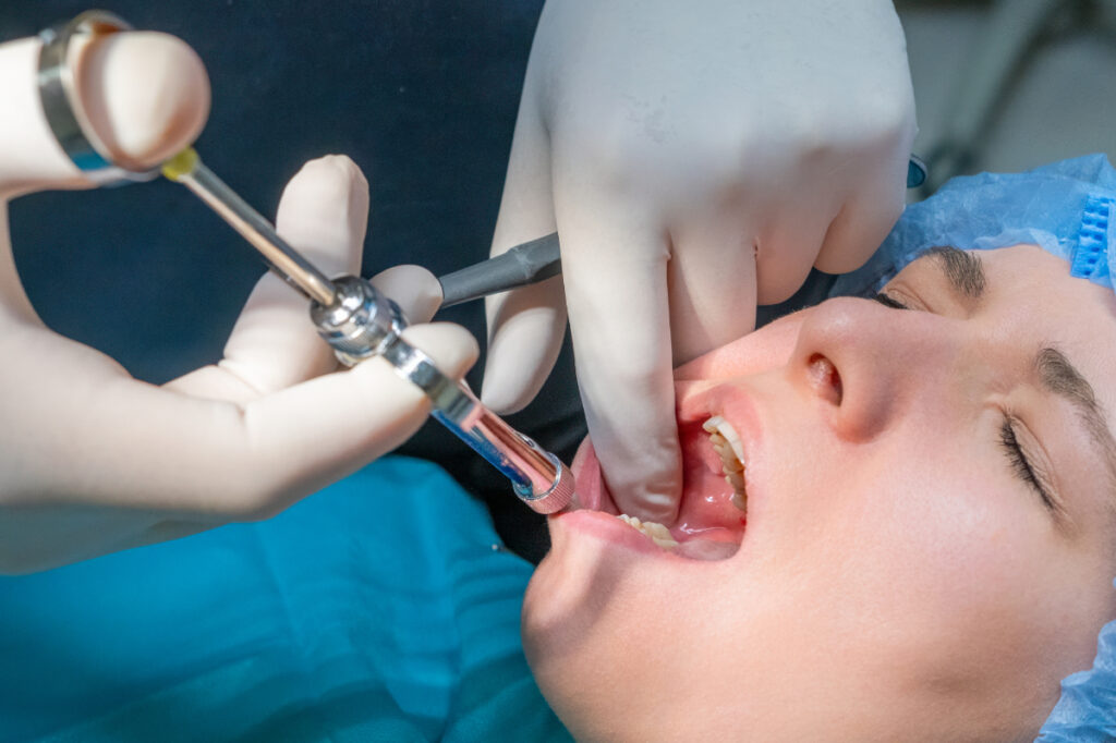 重度の歯周病の治療法